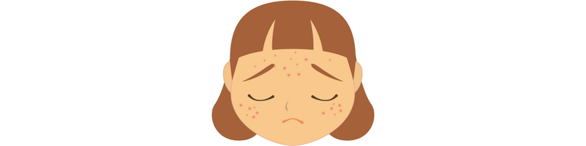Acne and Insecurities