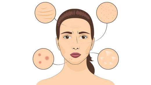 Understanding and Treating Pores: A Professional Perspective